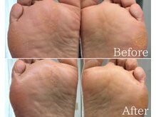 カシェット 広島店(Cachette)/50代女性☆足裏角質ケア90分