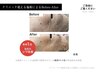 【お友達ご紹介クーポン】エレポで高濃度エクソソーム+幹細胞培養上清液導入