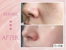 クリアラボ 錦糸町(Clear Lab)/韓国肌管理&毛穴洗浄専門店