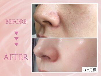 クリアラボ 錦糸町(Clear Lab)/韓国肌管理&毛穴洗浄専門店