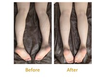 アッファシナンテ(Affascinante)/施術：オリジナル深筋骨メソッド