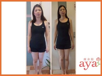 痩身館アヤ(aya)/耳つぼダイエット【富山/痩身】