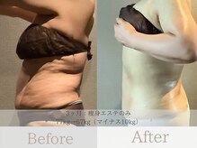 アージェム(AGEM)の雰囲気（3ヶ月-10kg減成功♪<インディバ/インディバエステ/フェイシャル>）
