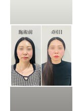 赤沼鍼灸整骨院/美・健康・笑顔に導く美容鍼
