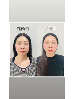 赤沼鍼灸整骨院/美・健康・笑顔に導く美容鍼
