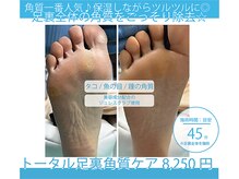 巻き爪補正店 秋葉原店の雰囲気（足裏全体の角質を除去してモチモチツルツルになると評判☆/角質）
