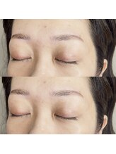 ネネ(nene.)/Hollywood brow lift