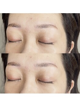ネネ(nene.)/Hollywood brow lift