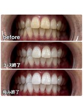 ティースペース(T-space)/極み