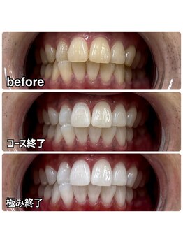 ティースペース(T-space)/極み