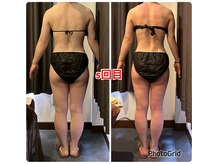 エステティックサロン リアン(Lien)/上半身痩せのお客様