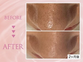 クリアラボ 池袋2nd(Clear Lab)/韓国肌管理&毛穴洗浄専門店