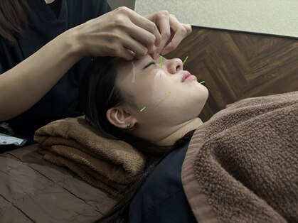 カエデ鍼灸整骨院 サンリブシティ小倉店(KAEDE鍼灸整骨院)の写真