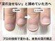深爪矯正専門ネイルサロン アニューの写真