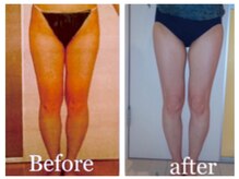 ビューティースパ/骨盤調整→むくみが取れ足が細く