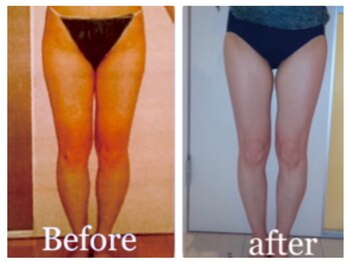 ビューティースパ/骨盤調整→むくみが取れ足が細く