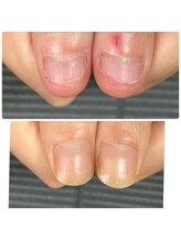 ウェルズユキ(well's yuki)/自爪を縦長にしたい！