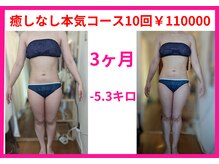 フレクシー/癒しなし本気コース10回