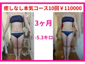 フレクシー/癒しなし本気コース10回