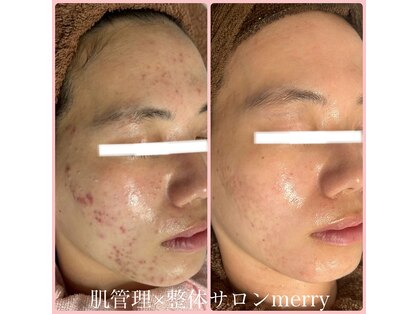 メリー 大和八木店(merry)の写真