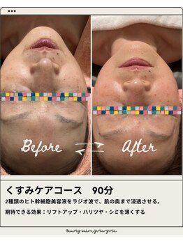 ユターユタ(yuta-yuta)/