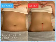 ティアワン 麻布十番(Tierone)/ウエストBefore & After