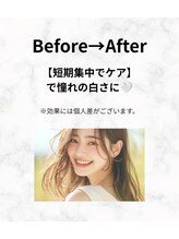 エミリアホワイトニング(EMIRIA WHITENING)/憧れの白さへ