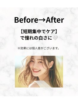 エミリアホワイトニング(EMIRIA WHITENING)/憧れの白さへ