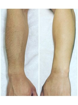 アントゥール 佐賀(ANTEUR)/