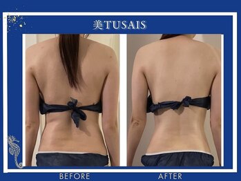 ビテュセ(美Tu sais)/【ダイエット・痩身】ボディケア