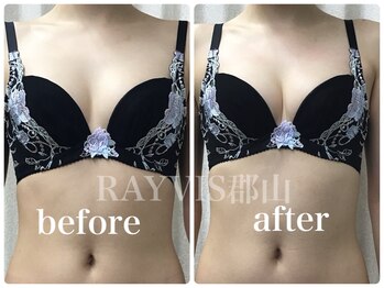レイビス 郡山店(RAYVIS)/体験後の驚きの変化♪3Dバスト2