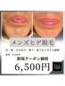 【ヒゲ メンズ脱毛】人気No.1デザインヒゲも◎全顔丸ごと脱毛8,800円→