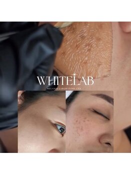 リシェル(Richelle)/【WHITELAB☆はがれるシミケア】