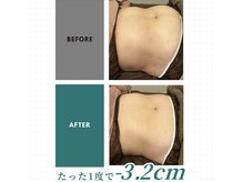 イリス 若葉台店(iiris)の雰囲気（韓国TOPクラスRO機使用。遺伝子にあわせた施術［痩身・リンパ］）