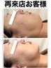 スッキリNO.1【透明美肌＋リンパ30】くすみゼロ肌たるみむくみ解消￥22000→