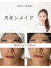 【迷った方はこちら】ツヤ肌爆誕栄養たっぷり高保湿トリートメント ¥7,000