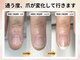 深爪矯正専門ネイルサロン アニューの写真