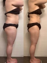 ジュメル 恵比寿店(Jumelles)/Before after