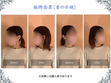 ボディ リセット アンド デザイン(Body Reset & Design)/【施術例】ビフォーアフター