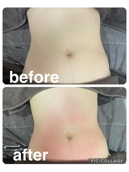 ギンザアール(GINZA R.)/【ウエストラインを綺麗に…＊】