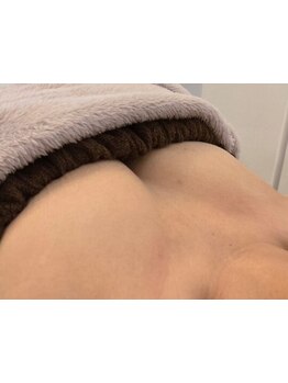 バストラインを整えたい