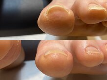 レヴィア(Revia)/