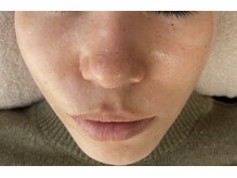 エステティックセラピー プレマ(PREMA)/凄い上がりかたに、、！