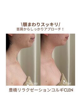 クレン(CLEN)/顎まわりスッキリ