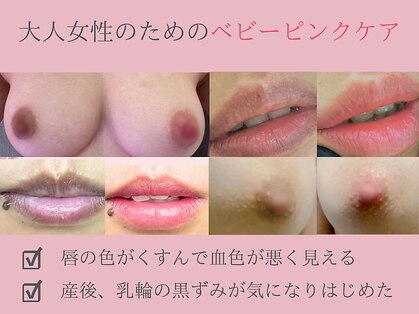 モンロー(MonroE+)の写真