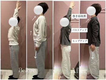 ユルル 刈谷店(Yururu)/ビフォーアフター(骨盤整体)