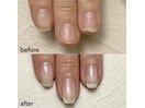 【自爪育成】before after