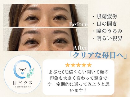 目ビウス 恵比寿本店の写真