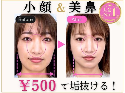 ラプリアンジュ 鹿児島天文館店(Raplit ange)の写真