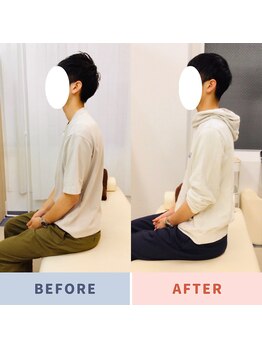 ナオル整体 三鷹院(NAORU整体)/20代男性施術事例【猫背姿勢】